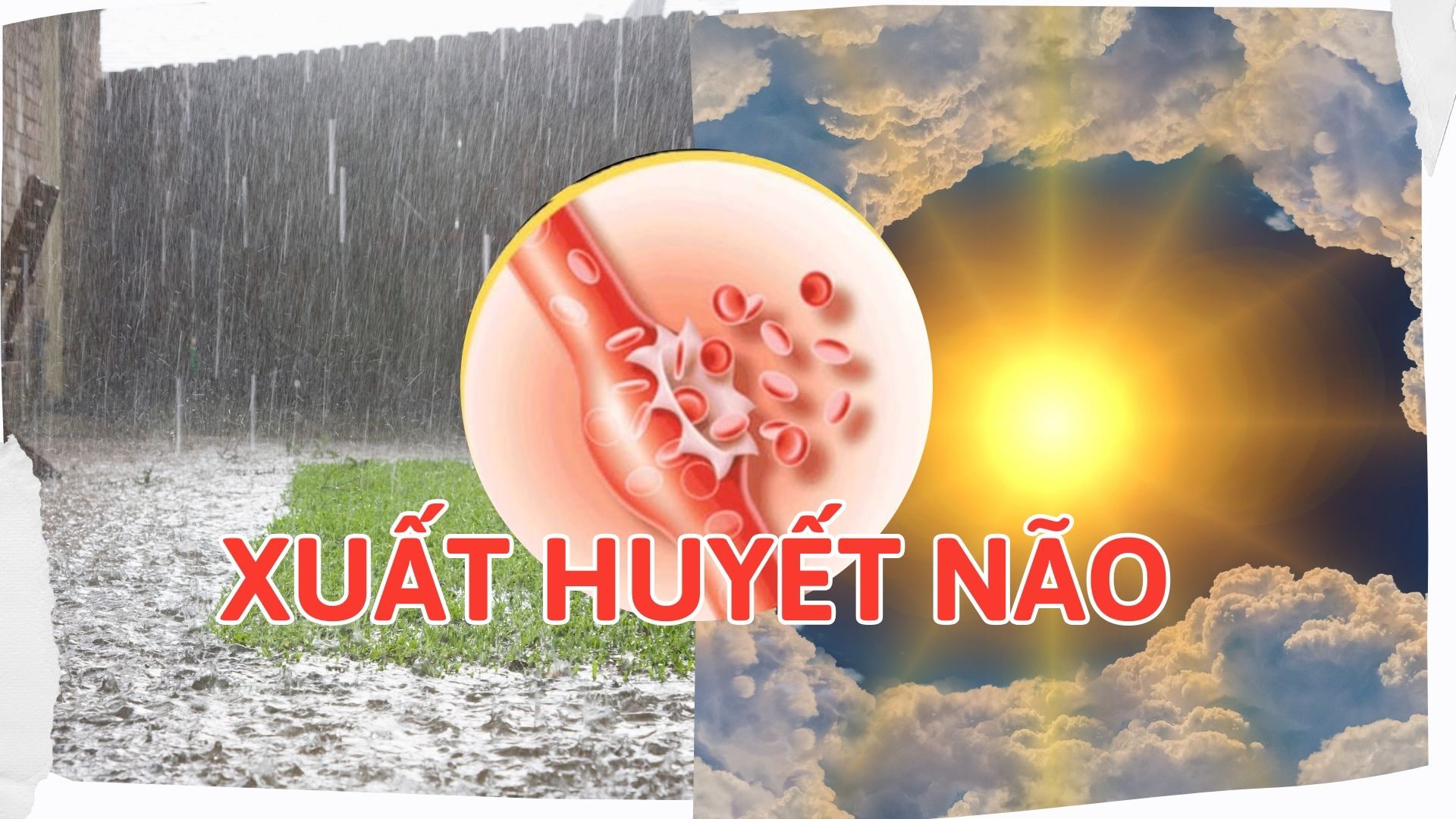 PGS Nguyễn Huy Thắng cảnh báo xuất huyết não tăng cao dịp cuối năm