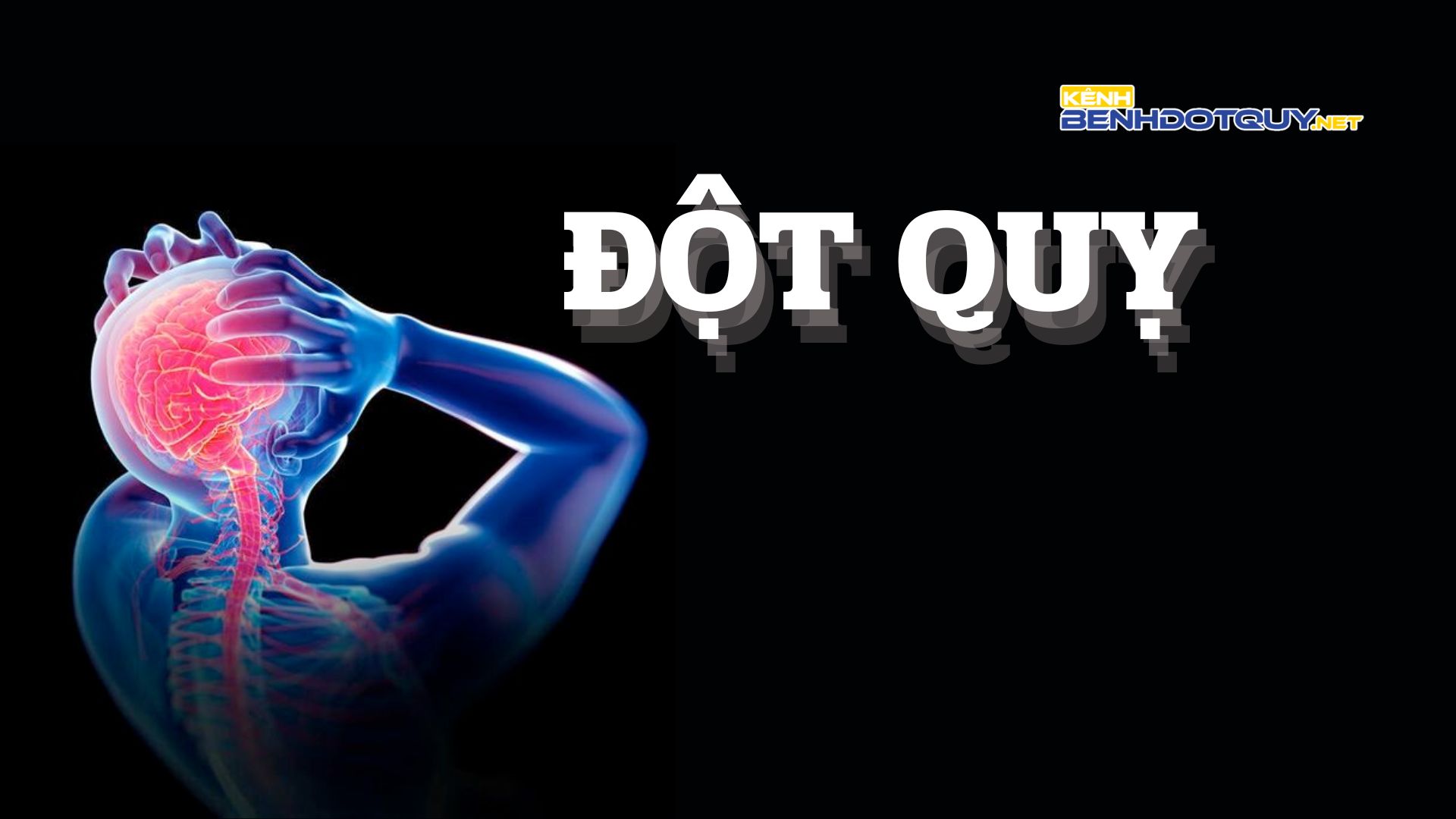 Đột quỵ: Nhận diện, chẩn đoán và điều trị