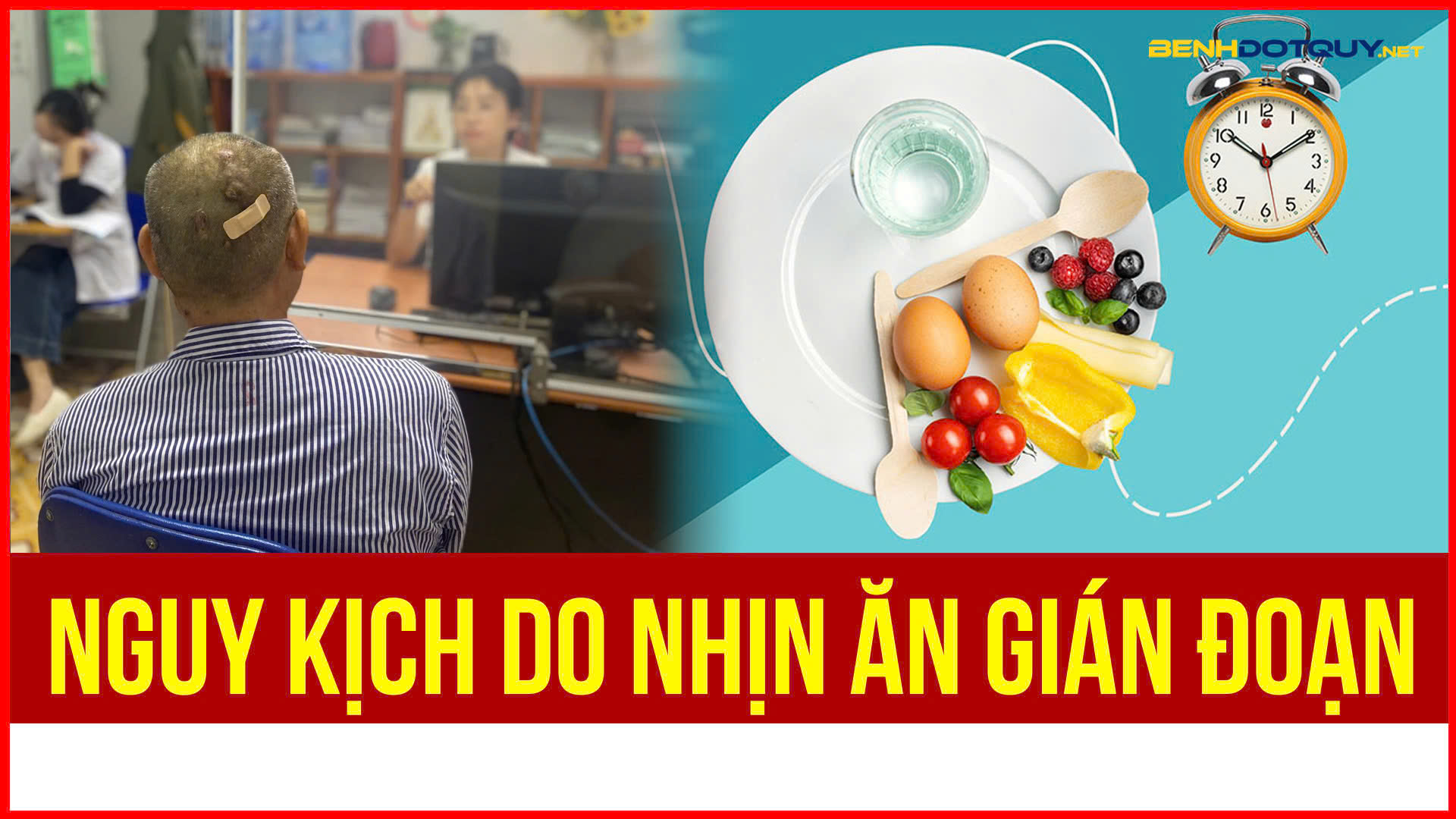 Biến chứng tiểu đường nghiêm trọng do nhịn ăn gián đoạn