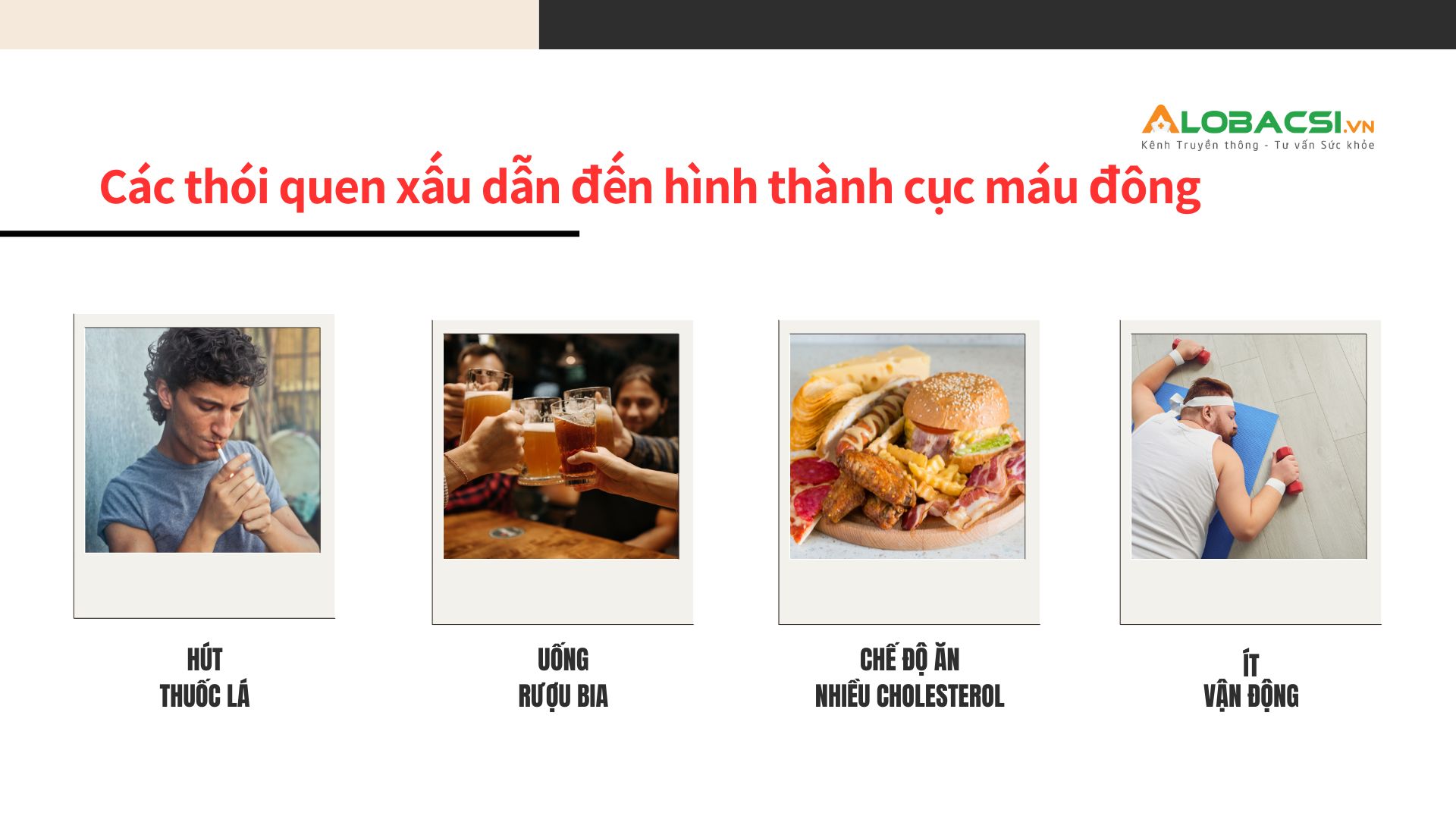 Tỷ lệ đột quỵ lên đến 80% nếu có cục máu đông trong tim