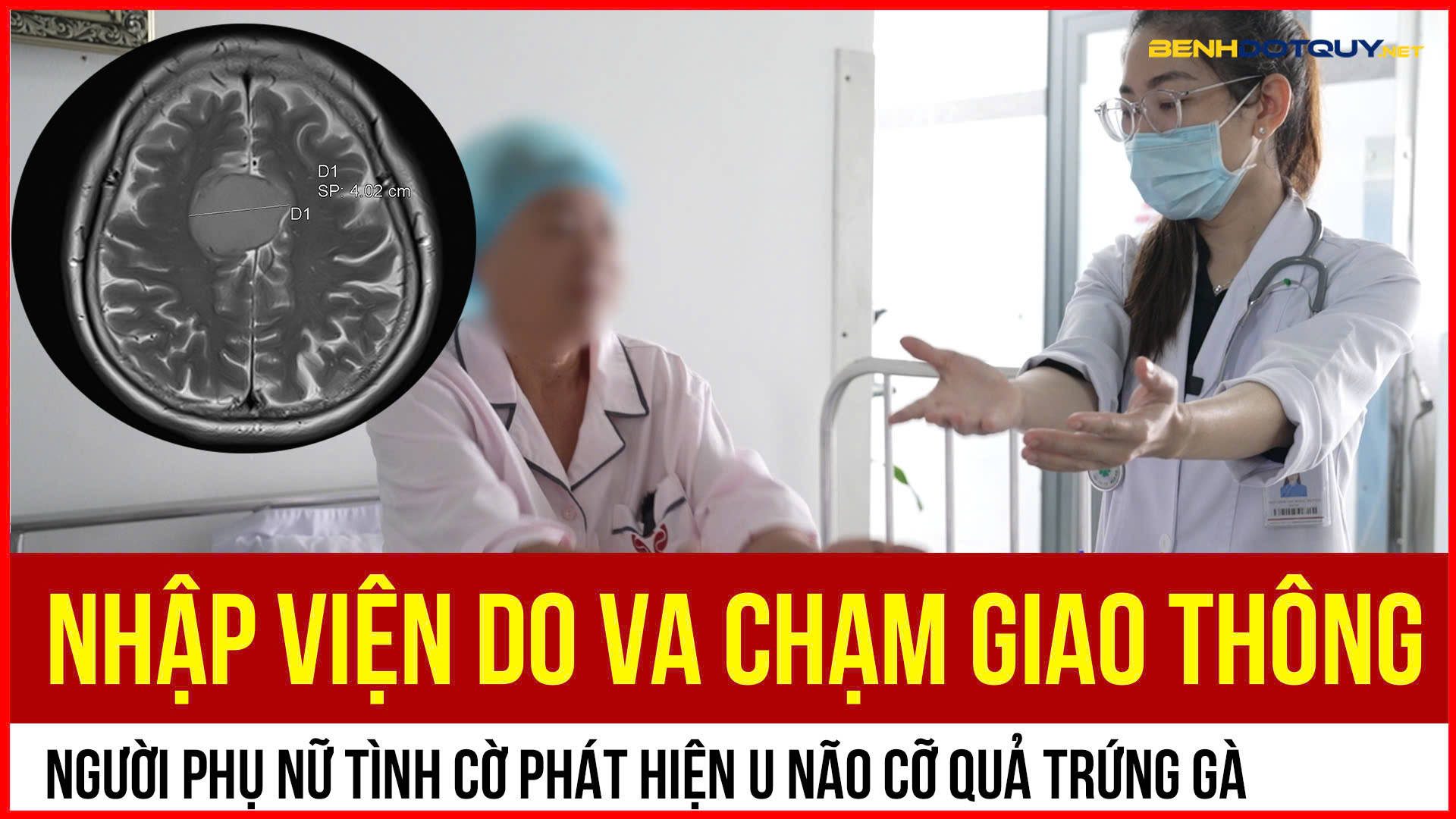 Nhập viện do va chạm giao thông, người phụ nữ tình cờ phát hiện u não cỡ quả trứng gà