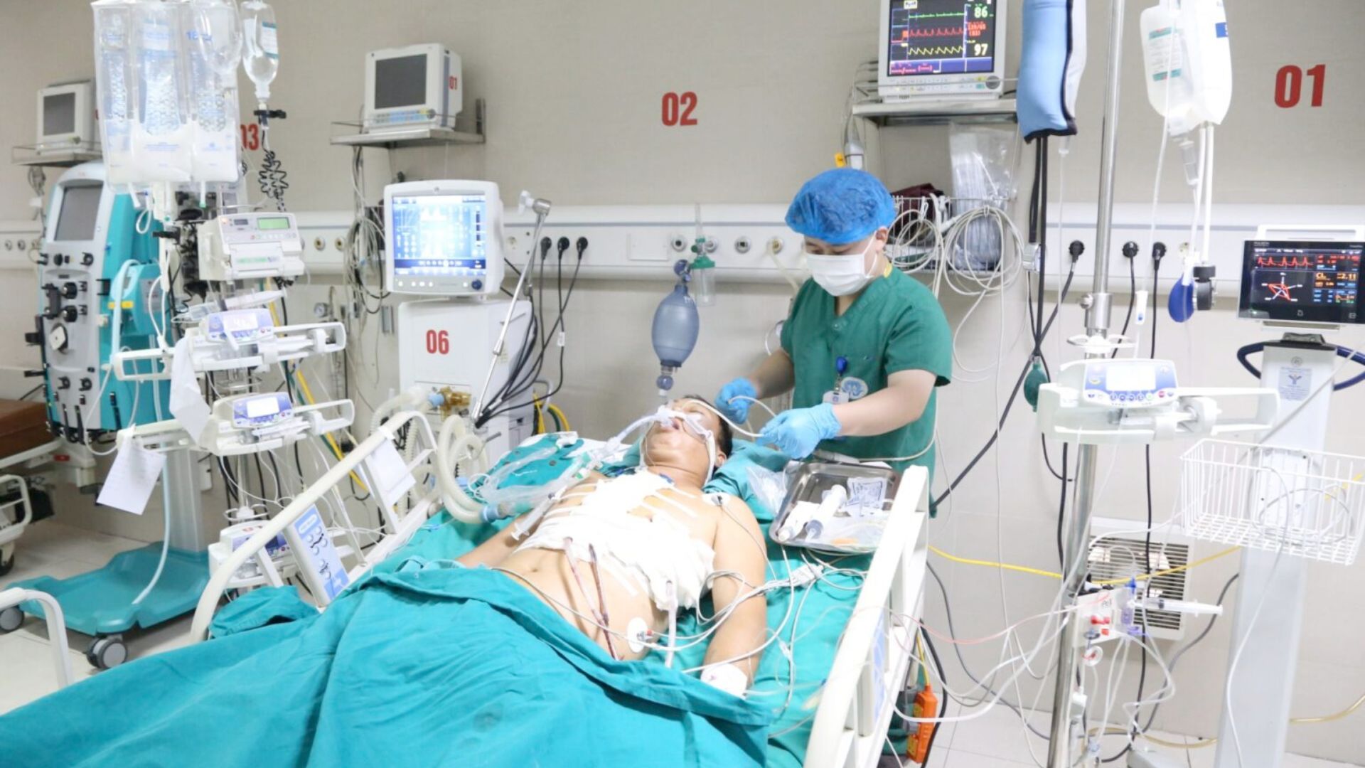 Truyền 8,5 lít máu cứu người đàn ông bị đâm xuyên thấu tim, phổi