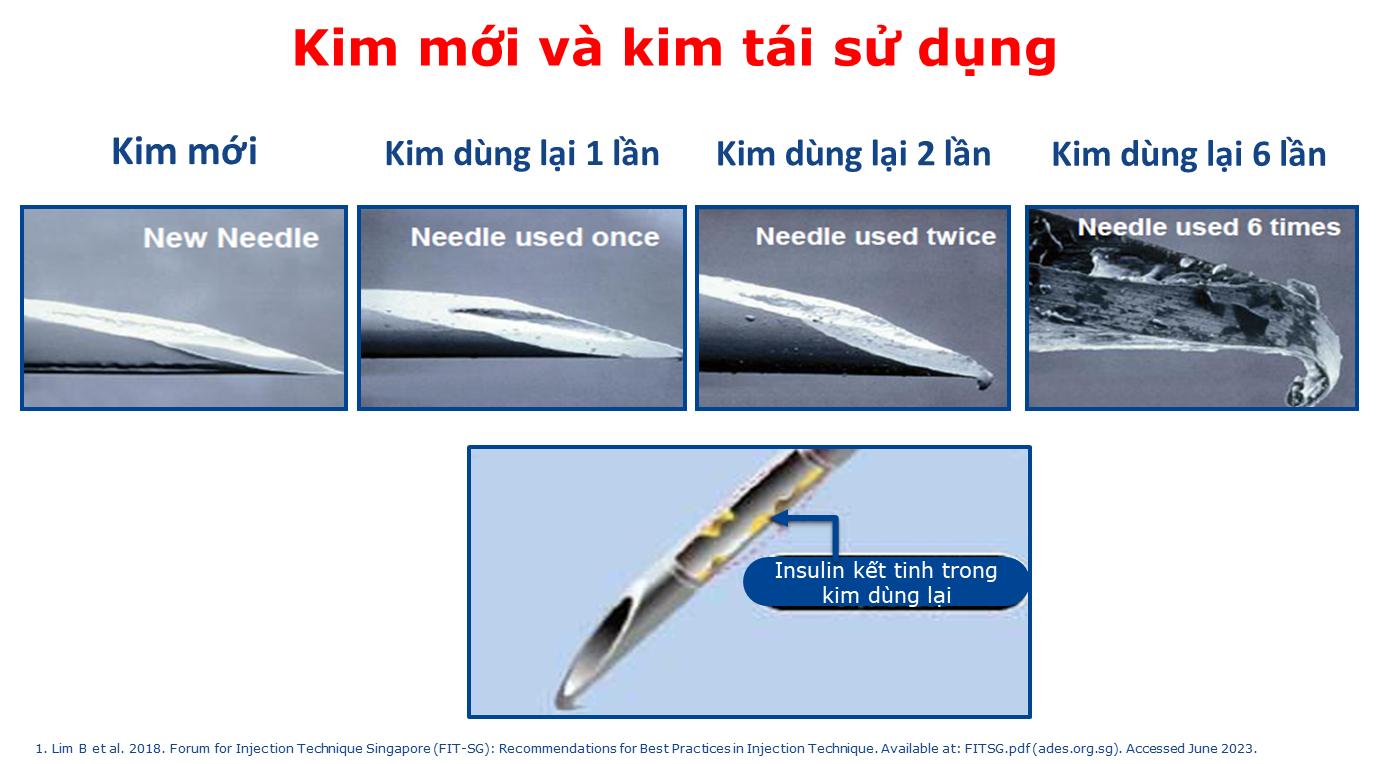 Nhiễm trùng, đau, loạn dưỡng mỡ do không thay kim tiêm insulin
