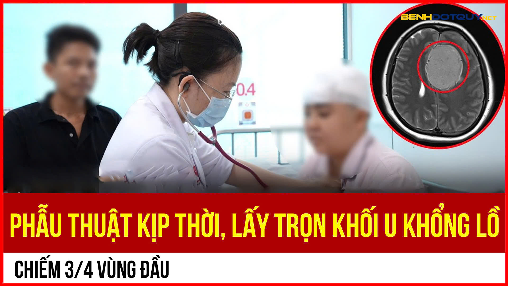 Phẫu thuật lấy trọn khối u khổng lồ chiếm 3/4 vùng đầu