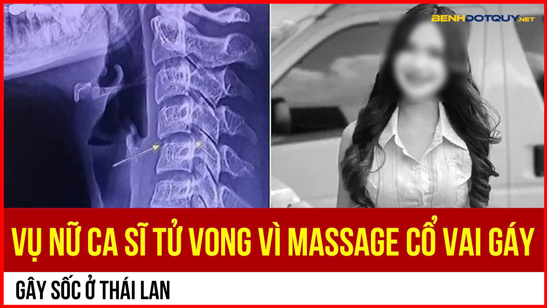 Nữ ca sĩ Thái Lan tử vong do massage cổ vai gáy