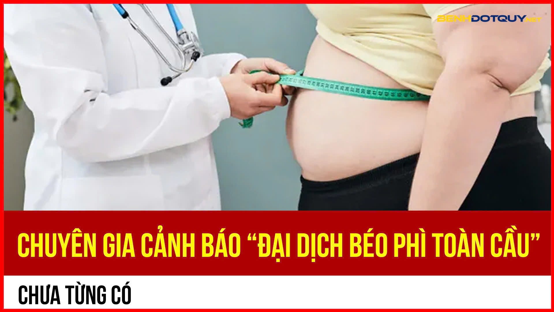 Chuyên gia cảnh báo “đại dịch béo phì toàn cầu” chưa từng có