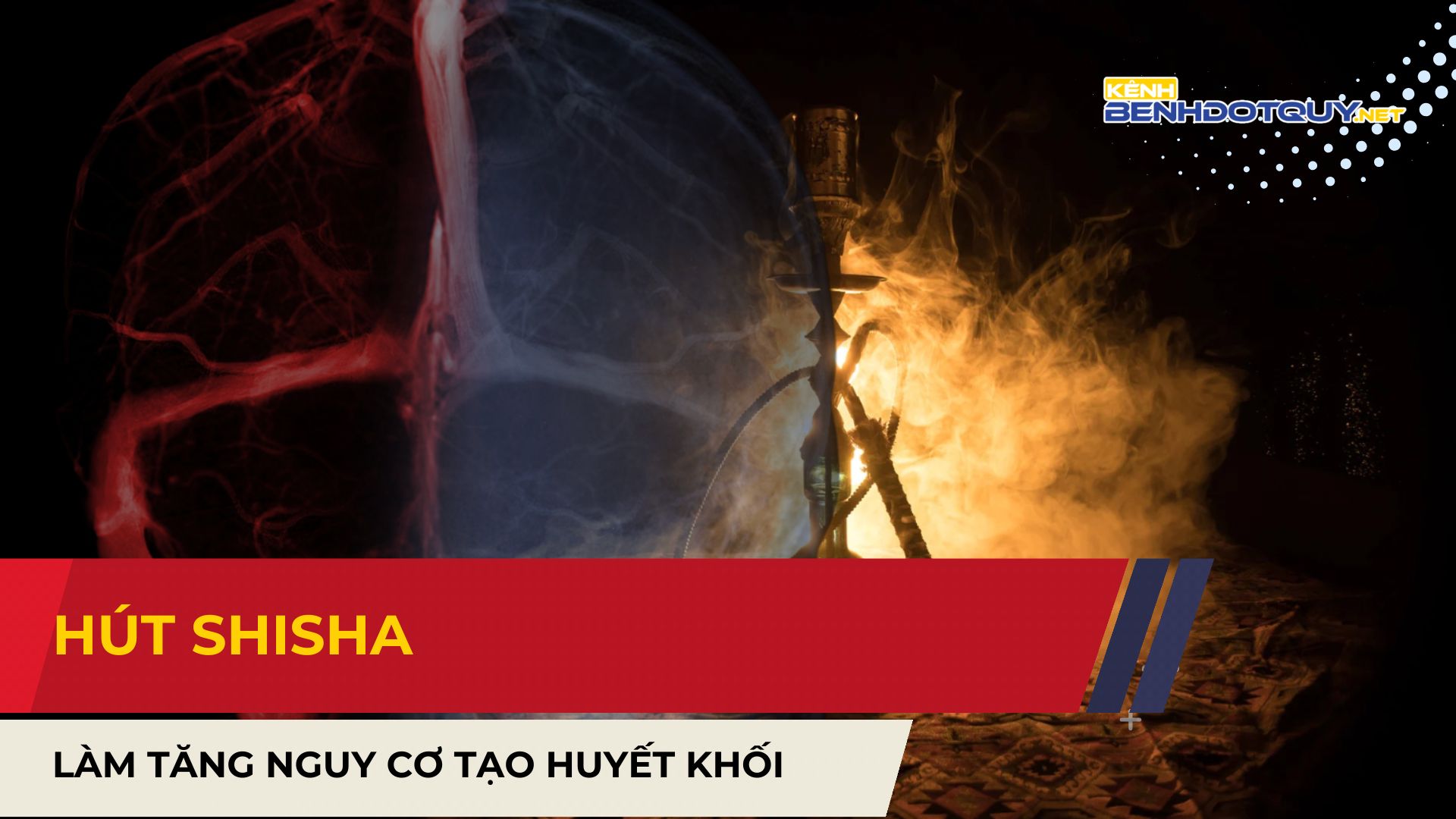 PGS Nguyễn Huy Thắng: Hút shisha làm tăng nguy cơ tạo huyết khối