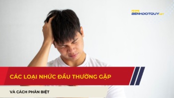 Phân biệt các loại nhức đầu thường gặp