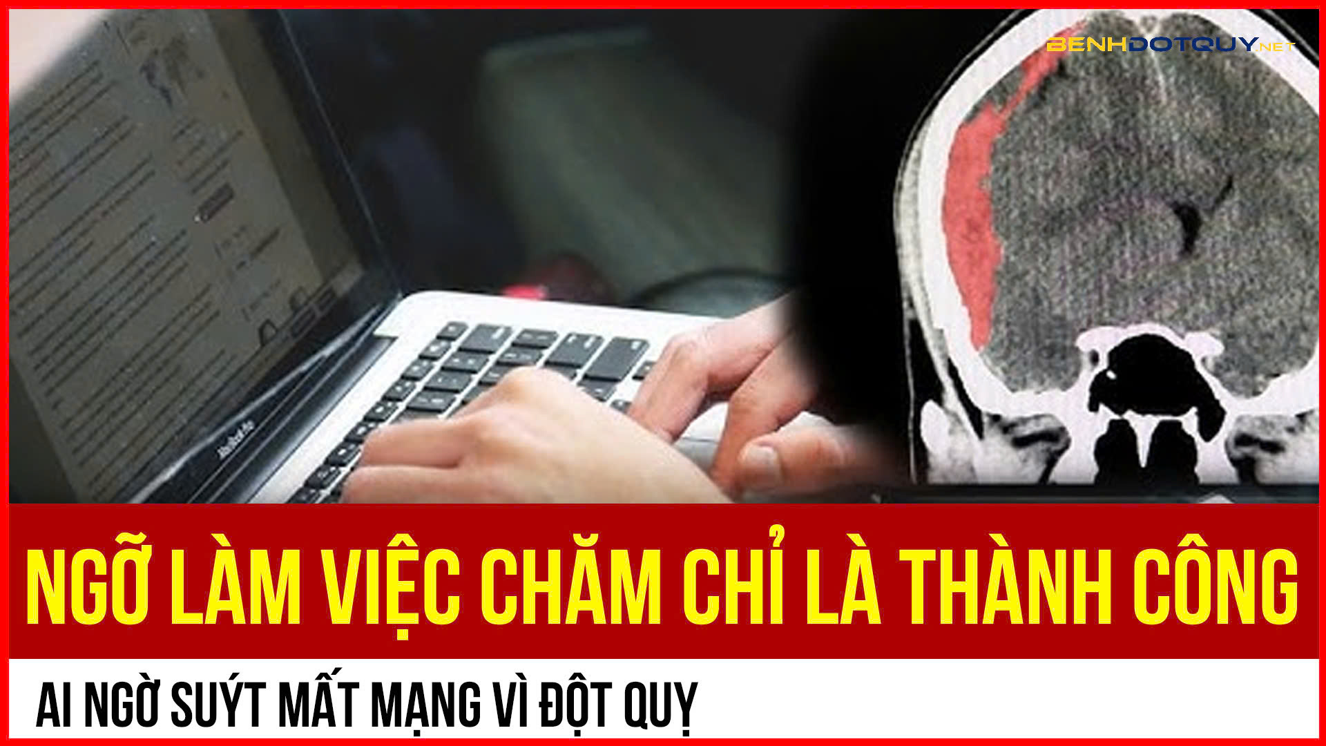 Ngỡ làm việc chăm chỉ là thành công, ai ngờ suýt mất mạng vì đột quỵ