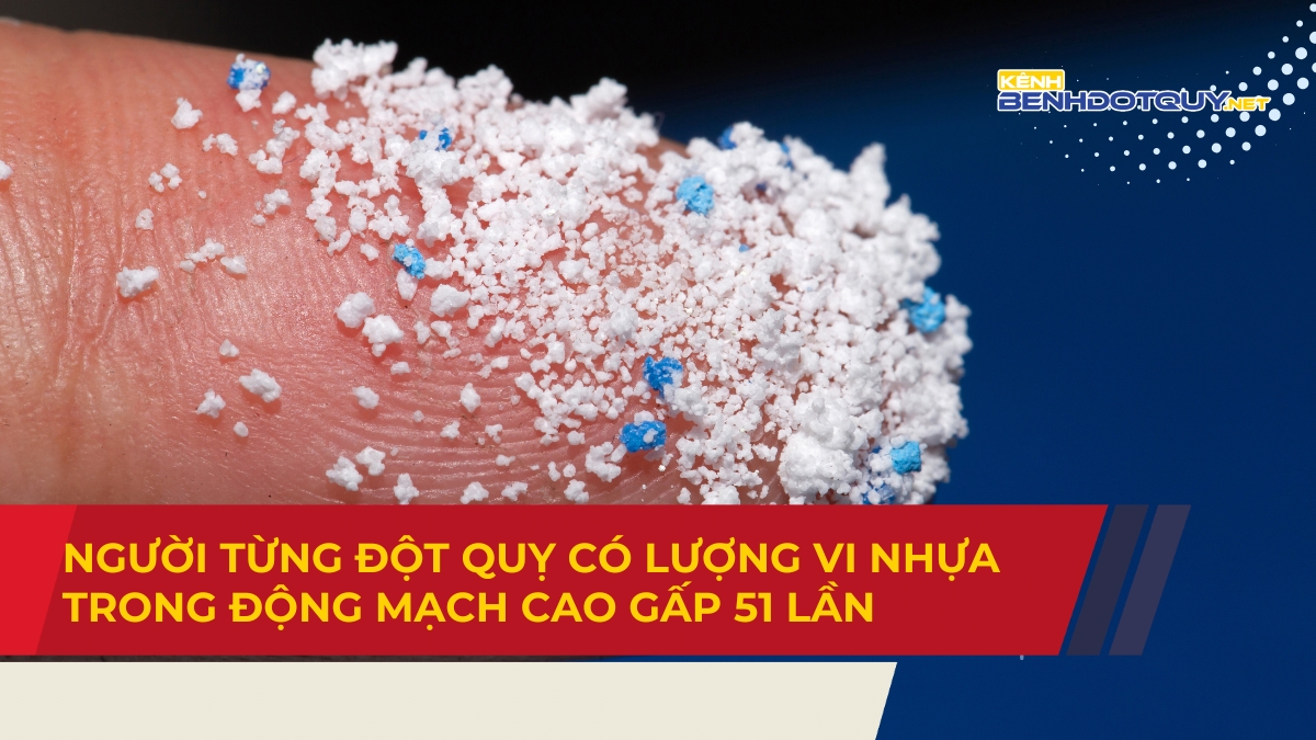 Người từng đột quỵ có lượng vi nhựa trong động mạch cao gấp 51 lần