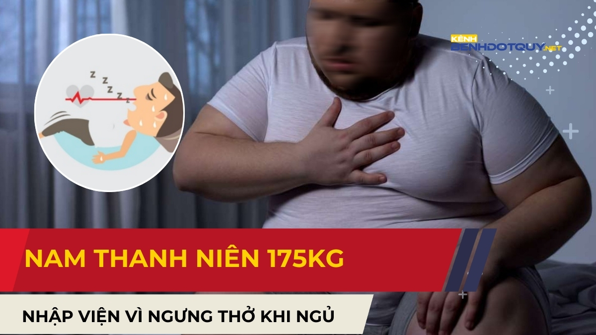 Nam thanh niên 175kg nhập viện vì ngưng thở khi ngủ