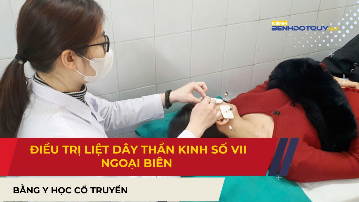 Điều trị liệt dây thần kinh số VII ngoại biên bằng Y học cổ truyền