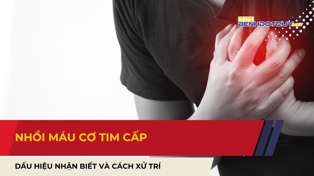 Nhồi máu cơ tim cấp: Dấu hiệu nhận biết và cách xử trí để cứu sống người bệnh