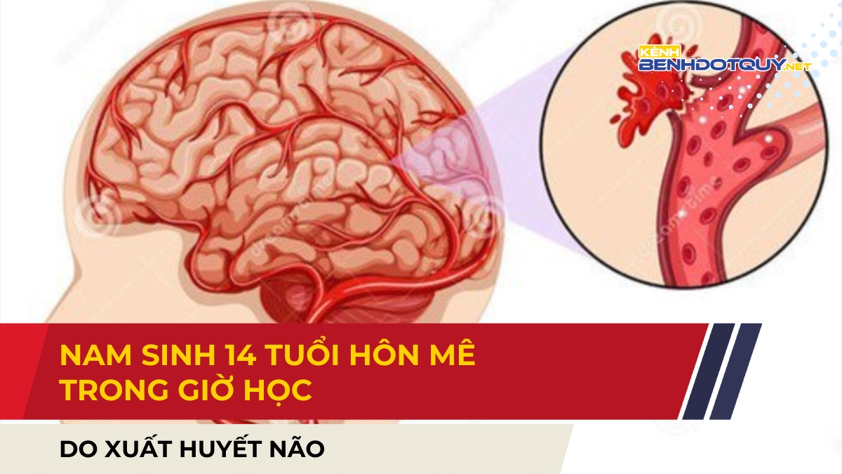 Hà Tĩnh: Nam sinh 14 tuổi hôn mê trong giờ học do xuất huyết não