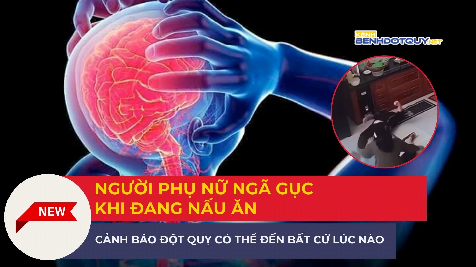 Người phụ nữ ngã gục khi đang nấu ăn: Cảnh báo nguy cơ đột quỵ có thể ập đến bất kỳ lúc nào