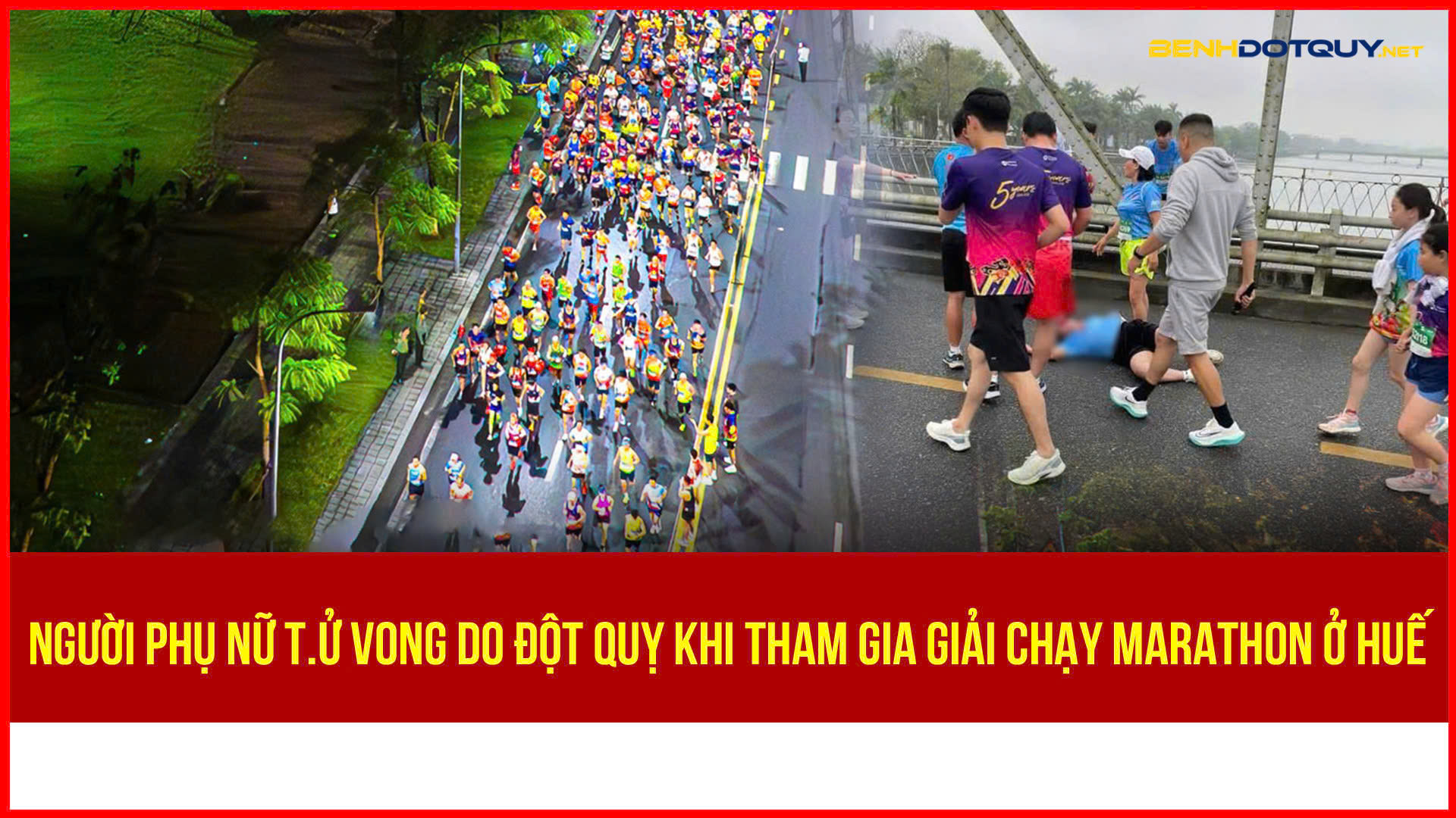Bệnh viện TW Huế tiếp nhận 4 trường hợp có vấn đề sức khỏe khi tham gia giải Marathon trên địa bàn thành phố