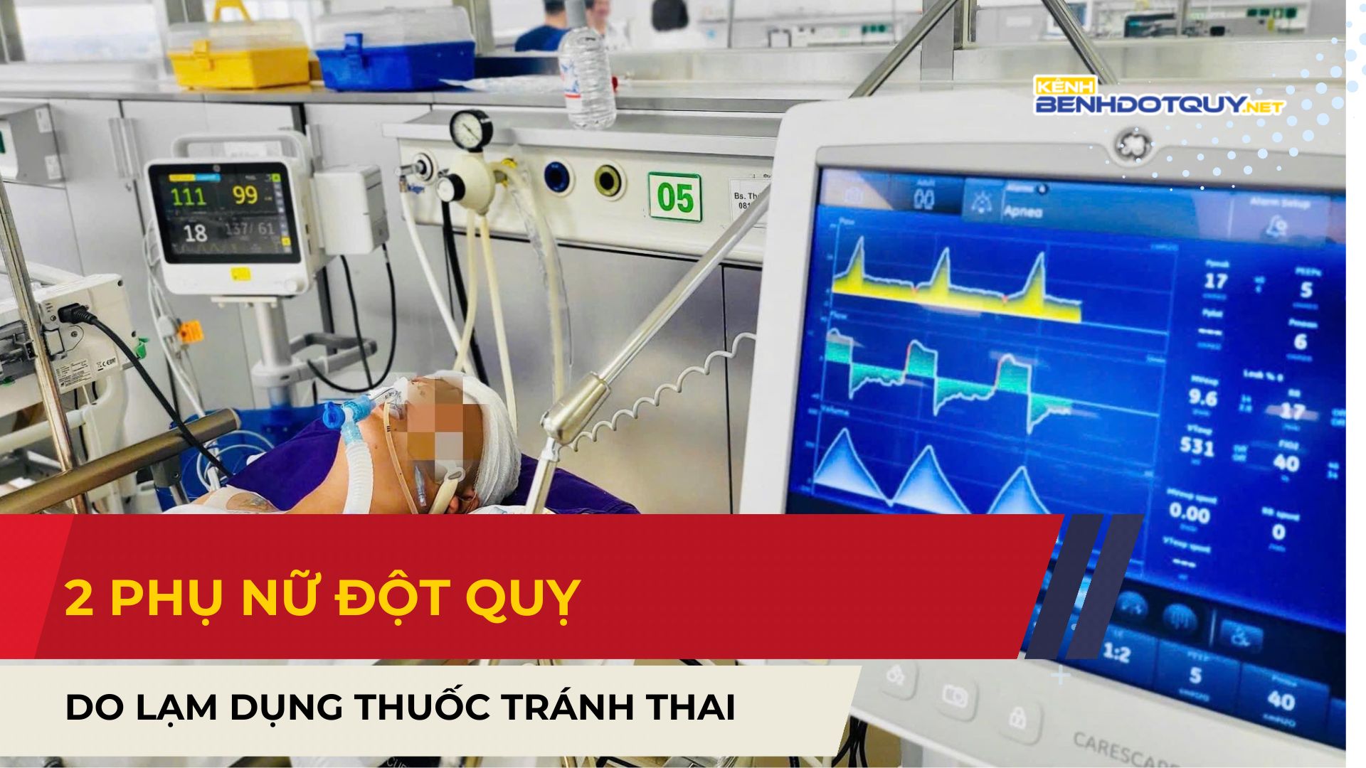 Nhập viện cấp cứu đột quỵ do lạm dụng thuốc tránh thai và cảnh báo từ bác sĩ