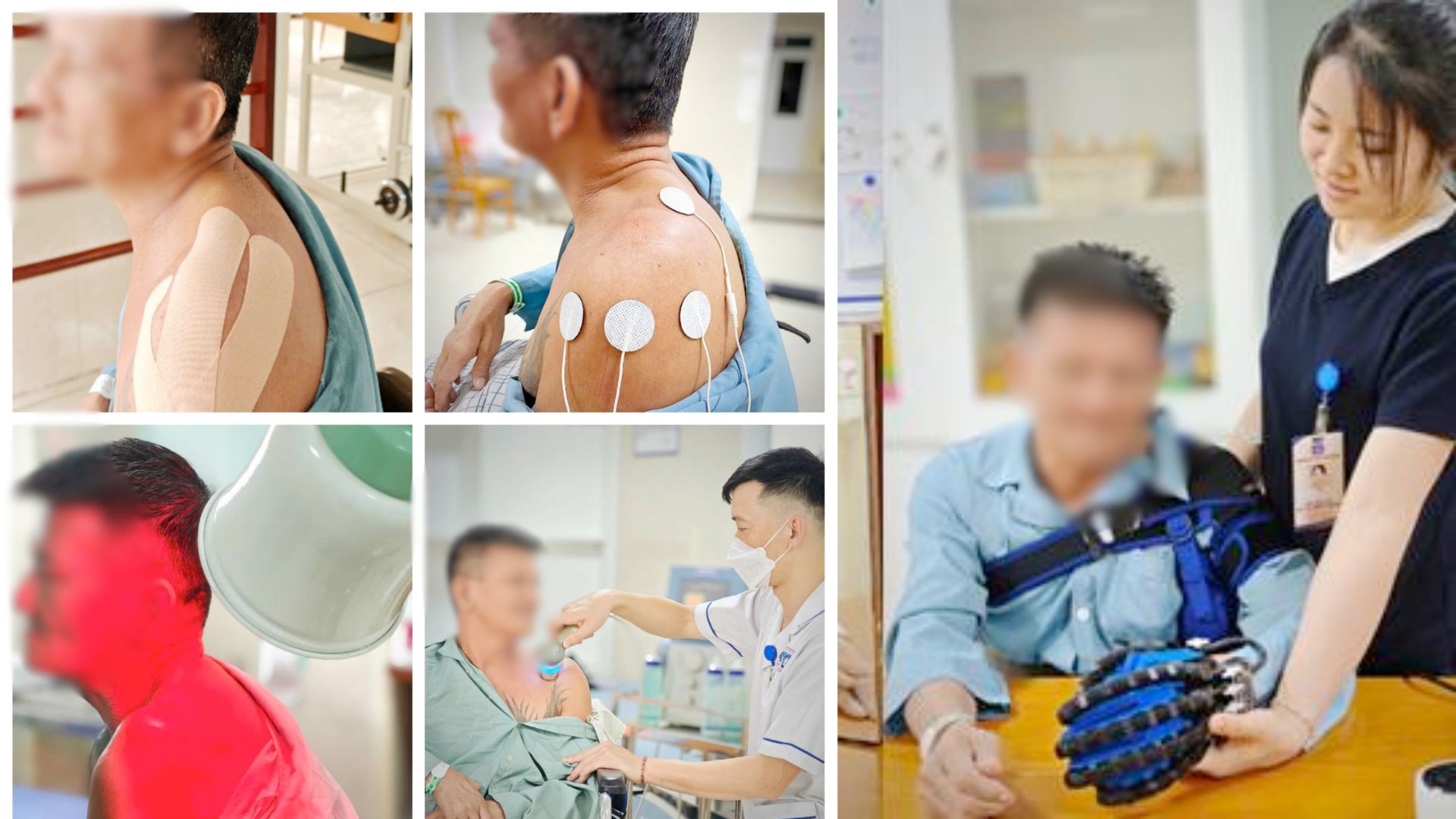 Phú Thọ: Nam bệnh nhân liệt nửa người do đột quỵ tự đi lại sau 3 tháng kiên trì tập phục hồi chức năng