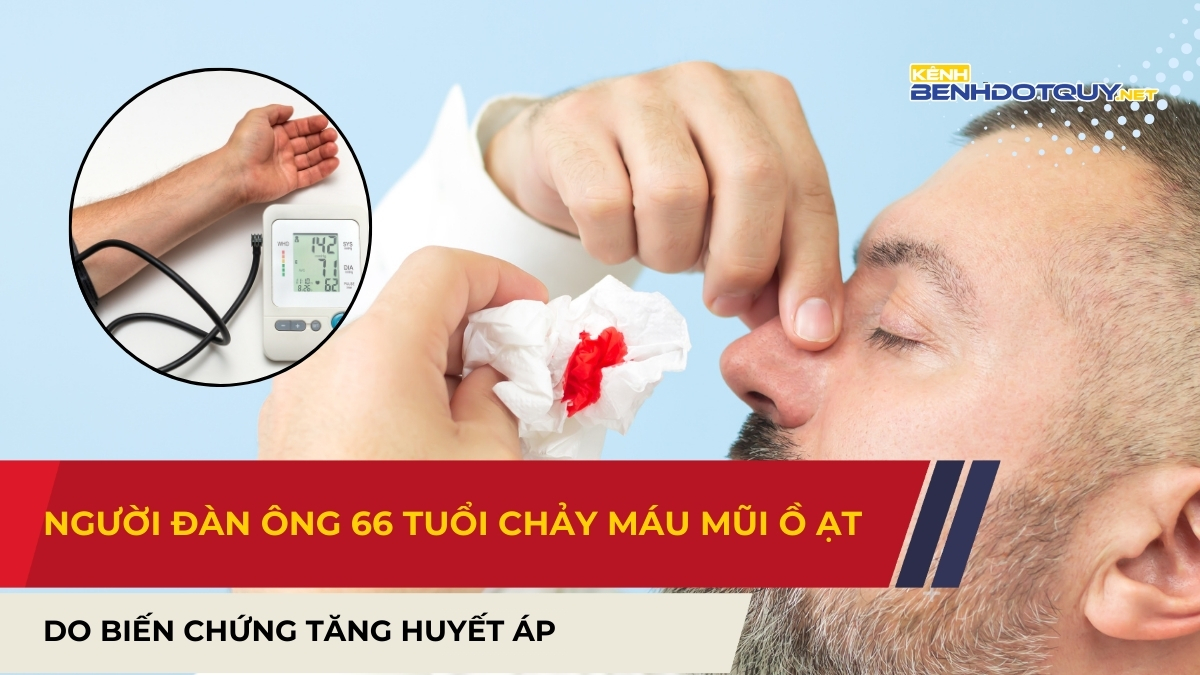 Chảy máu mũi ồ ạt do biến chứng tăng huyết áp