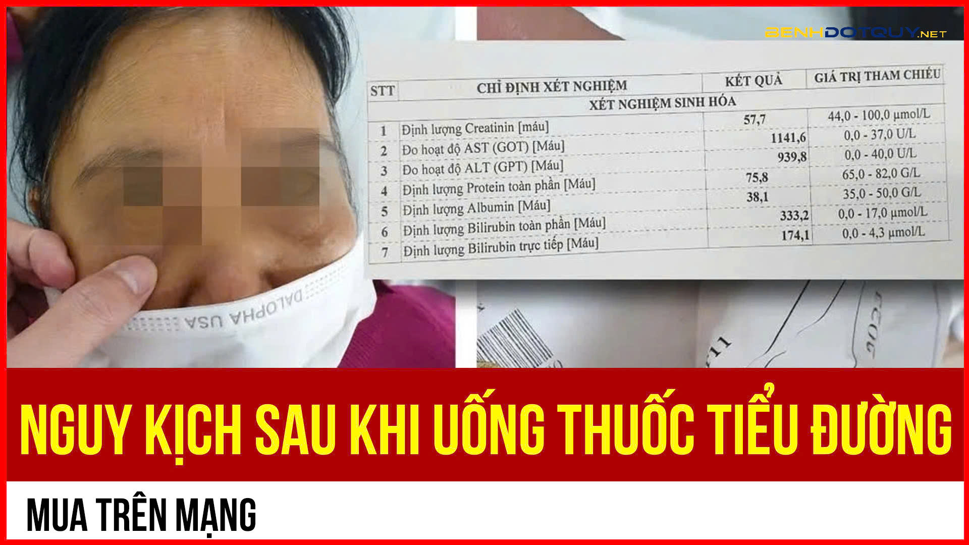 Bệnh nhân tiểu đường nhập viện vì uống nhầm thuốc chứa Phenformin