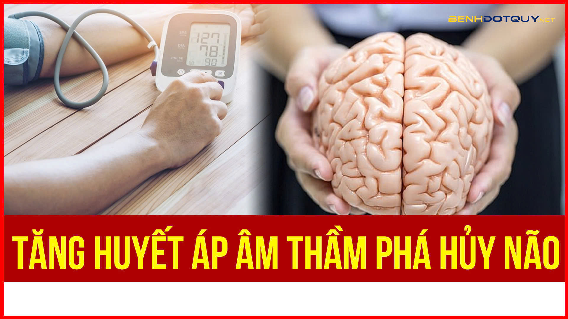 Tăng huyết áp âm thầm phá hủy não