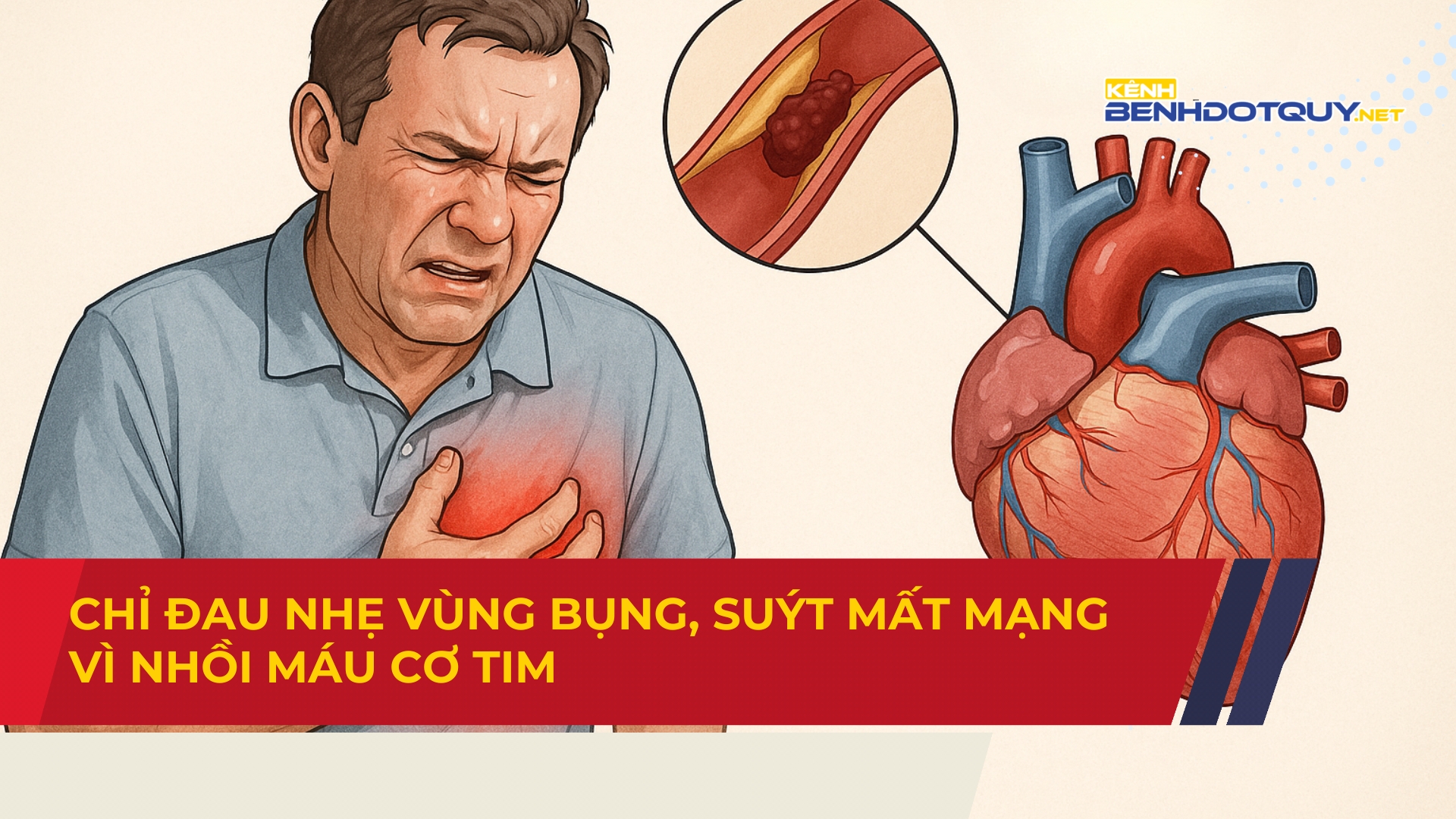 Chỉ đau nhẹ vùng bụng, suýt mất mạng vì nhồi máu cơ tim