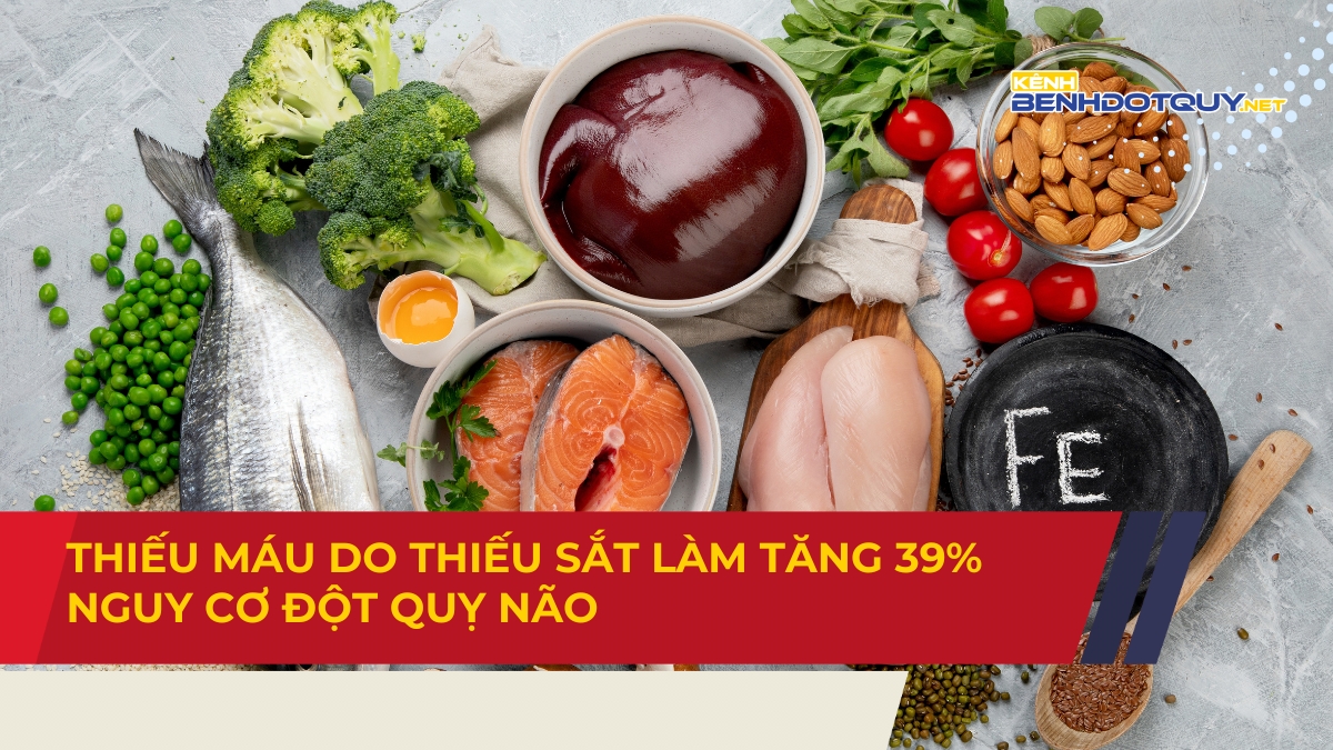 Thiếu máu do thiếu sắt làm tăng 39% nguy cơ đột quỵ não