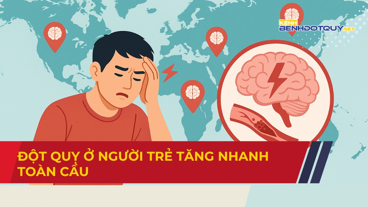Báo động đột quỵ ở người trẻ tăng nhanh toàn cầu