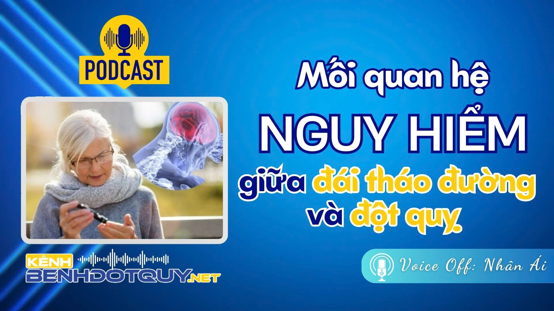 Giải mã mối quan hệ nguy hiểm giữa đái tháo đường và đột quỵ