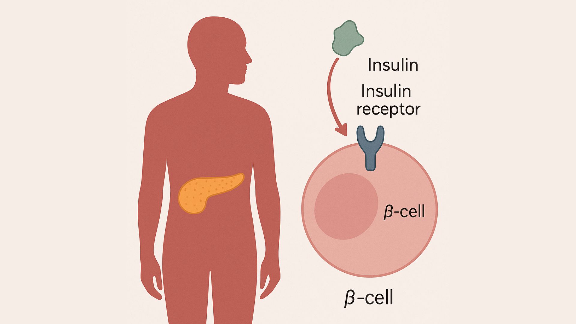 Kháng insulin ở bệnh nhân đái tháo đường type 1: Thật hay ảo?