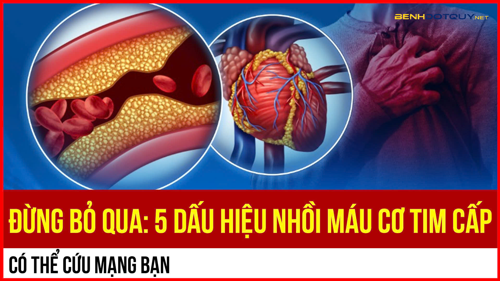 5 dấu hiệu cảnh báo nhồi máu cơ tim cấp