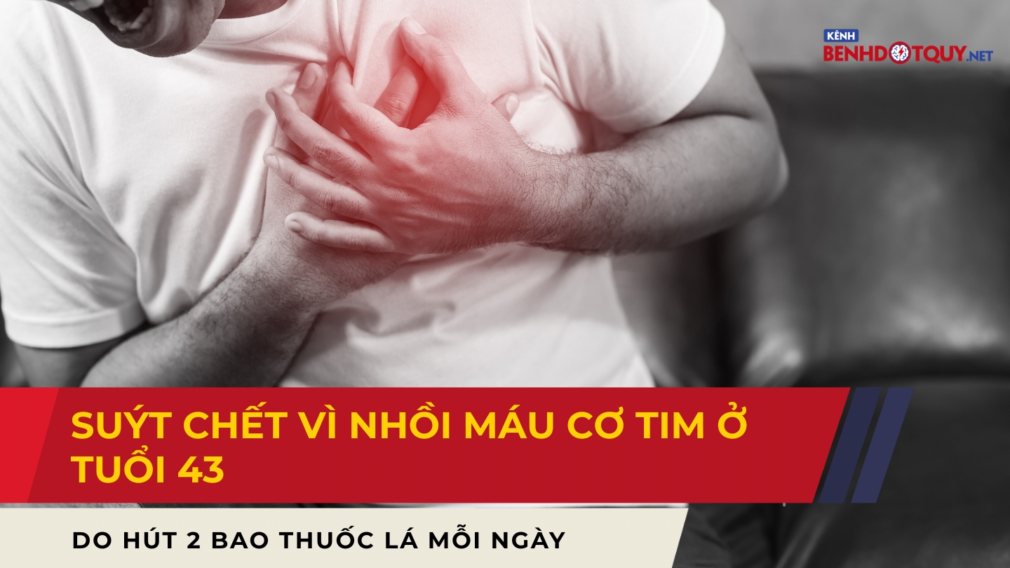 Suýt chết vì nhồi máu cơ tim ở tuổi 43 do hút 2 bao thuốc lá mỗi ngày