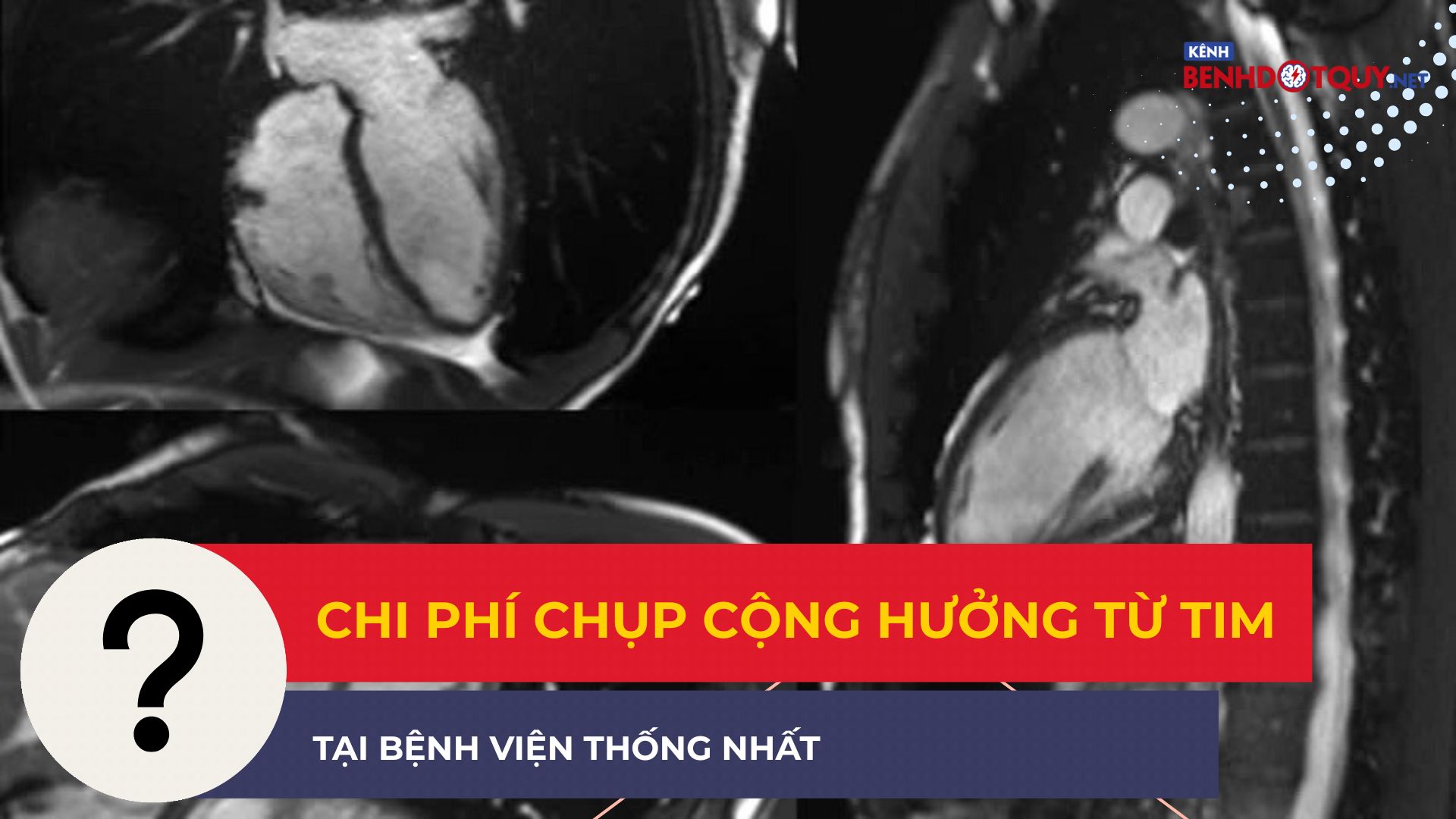 Chi phí chụp cộng hưởng từ tim tại Bệnh viện Thống Nhất