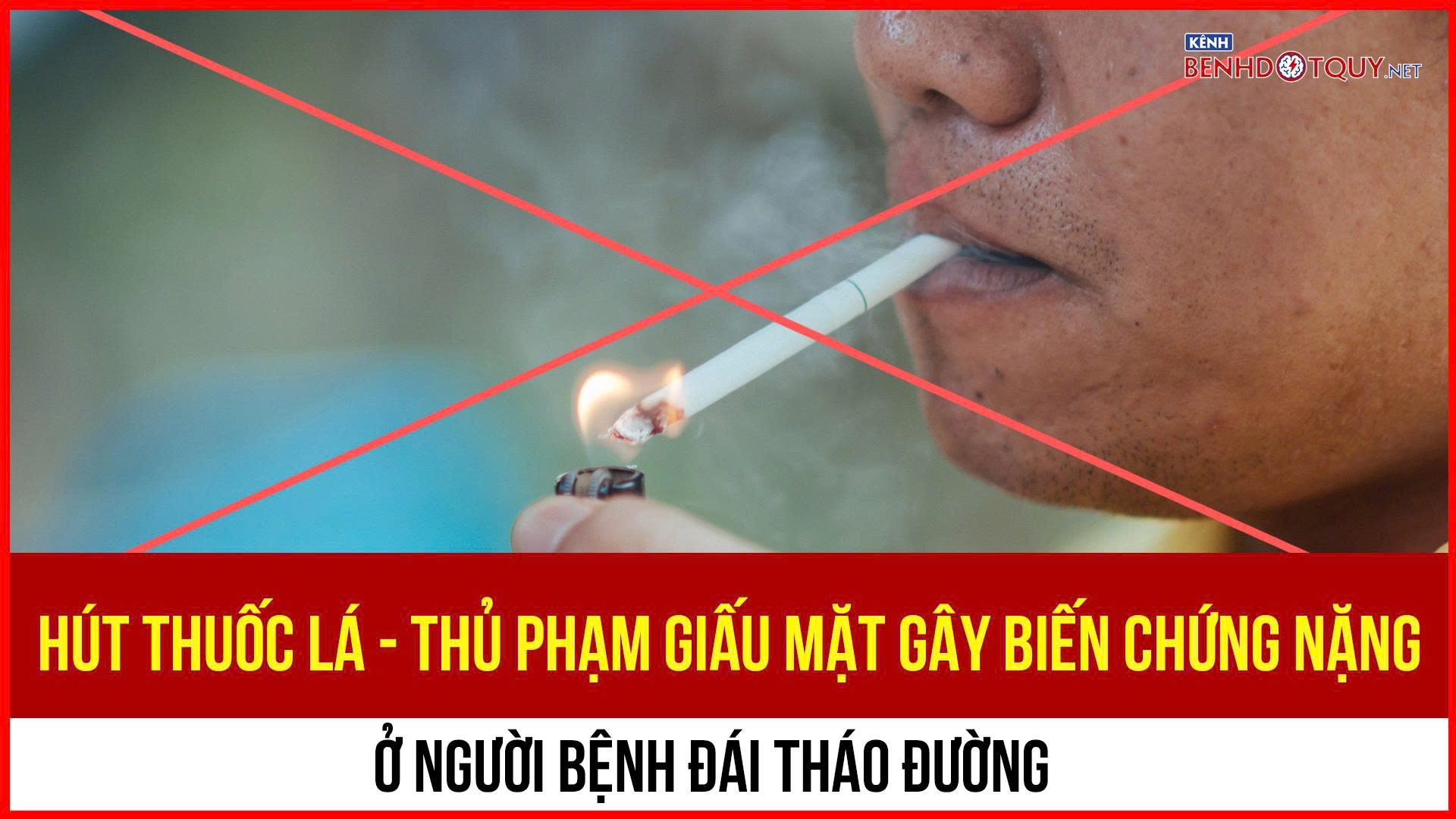 Hút thuốc lá – Thủ phạm giấu mặt gây biến chứng nặng ở người bệnh đái tháo đường