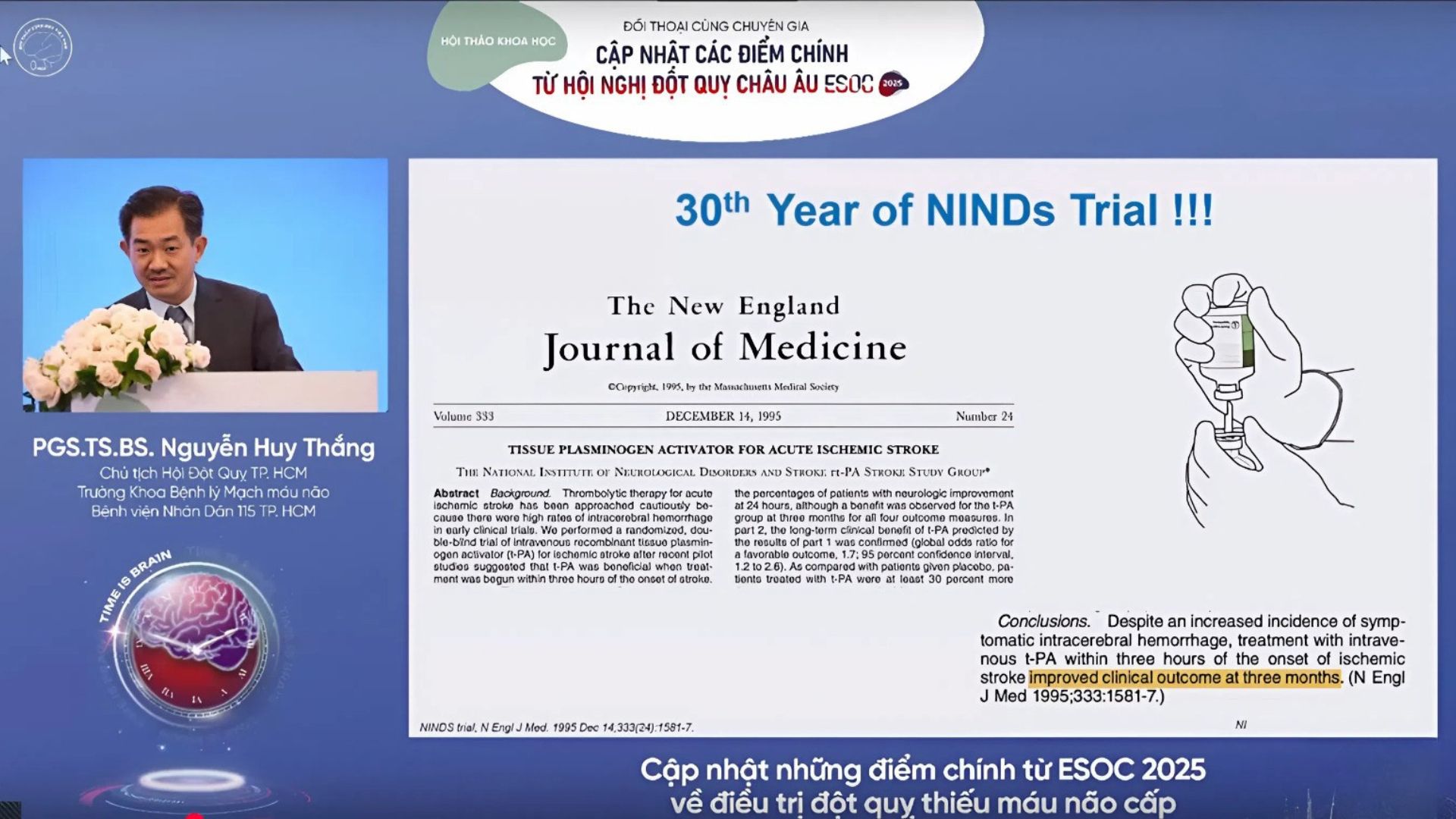 ESOC 2025: Kỷ nguyên mới của tiêu sợi huyết và tái thông mạch trong đột quỵ