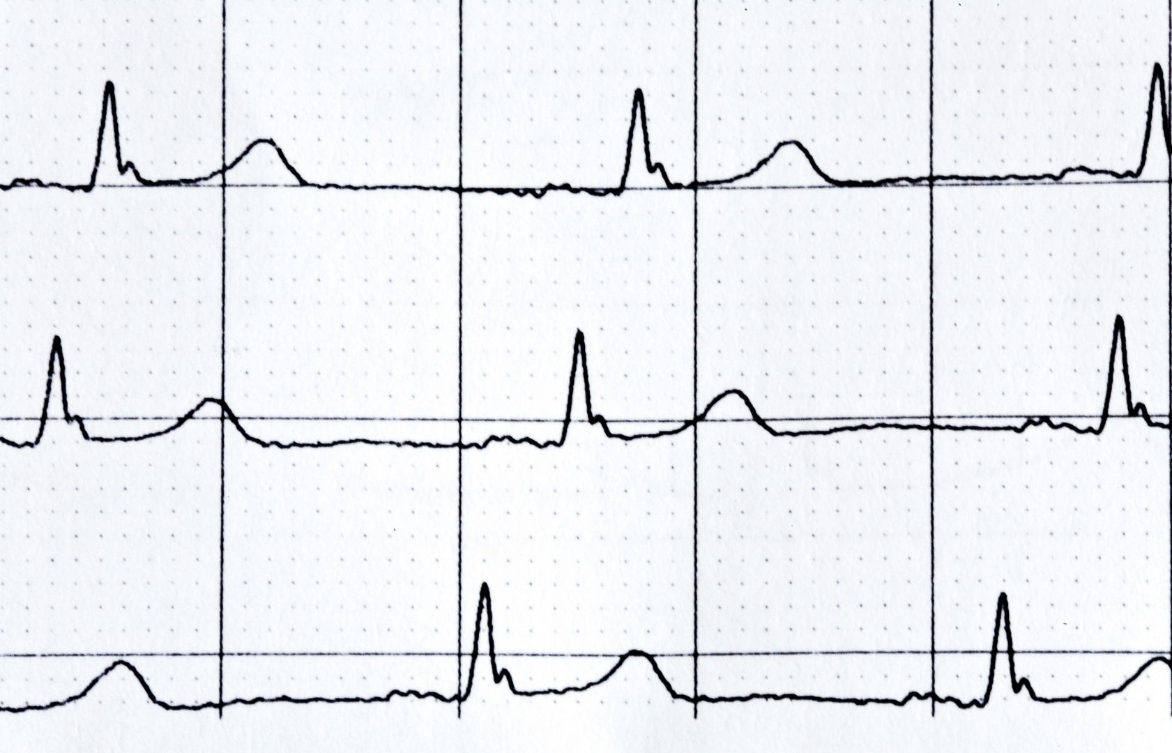 4 dấu hiệu cảnh báo cần dừng tập ngay lập tức để tránh đột tử