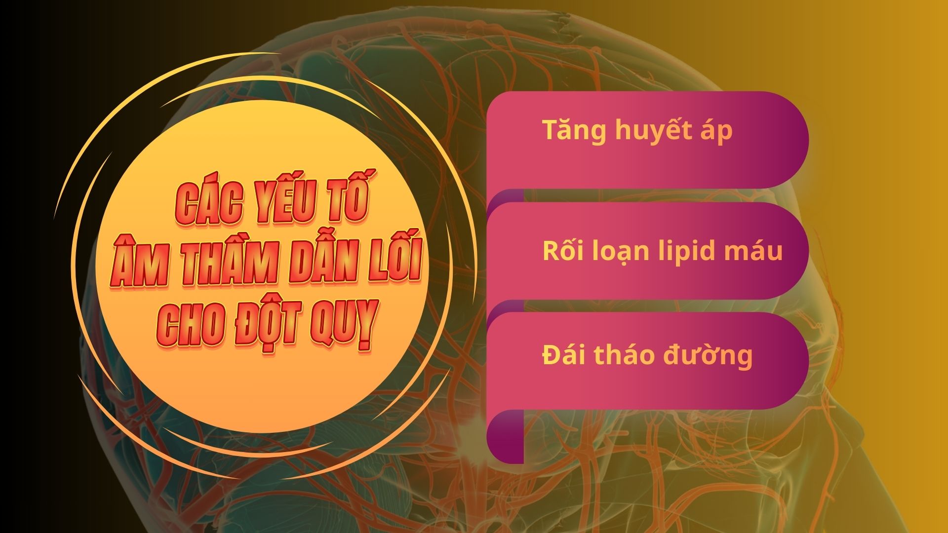 Những yếu tố âm thầm làm tăng nguy cơ đột quỵ