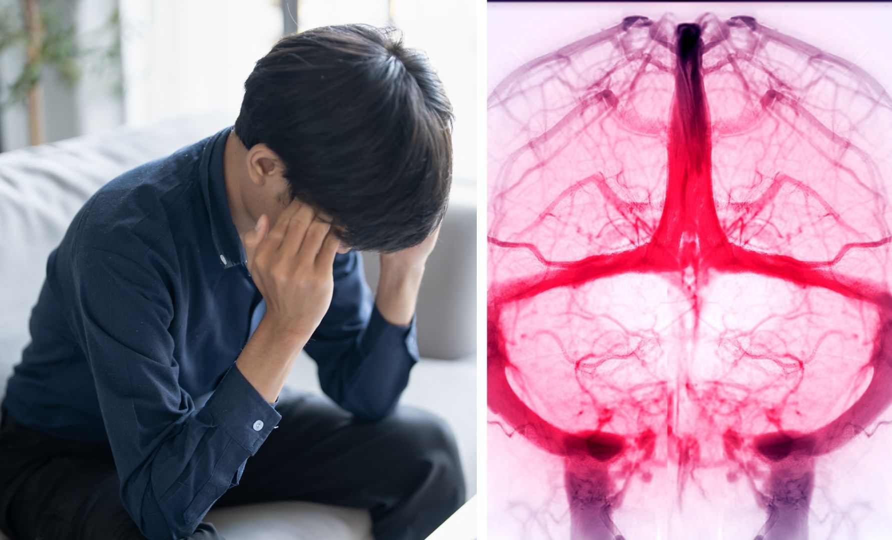 Huyết khối tĩnh mạch não – Căn bệnh hiếm nhưng có thể đe dọa tính mạng