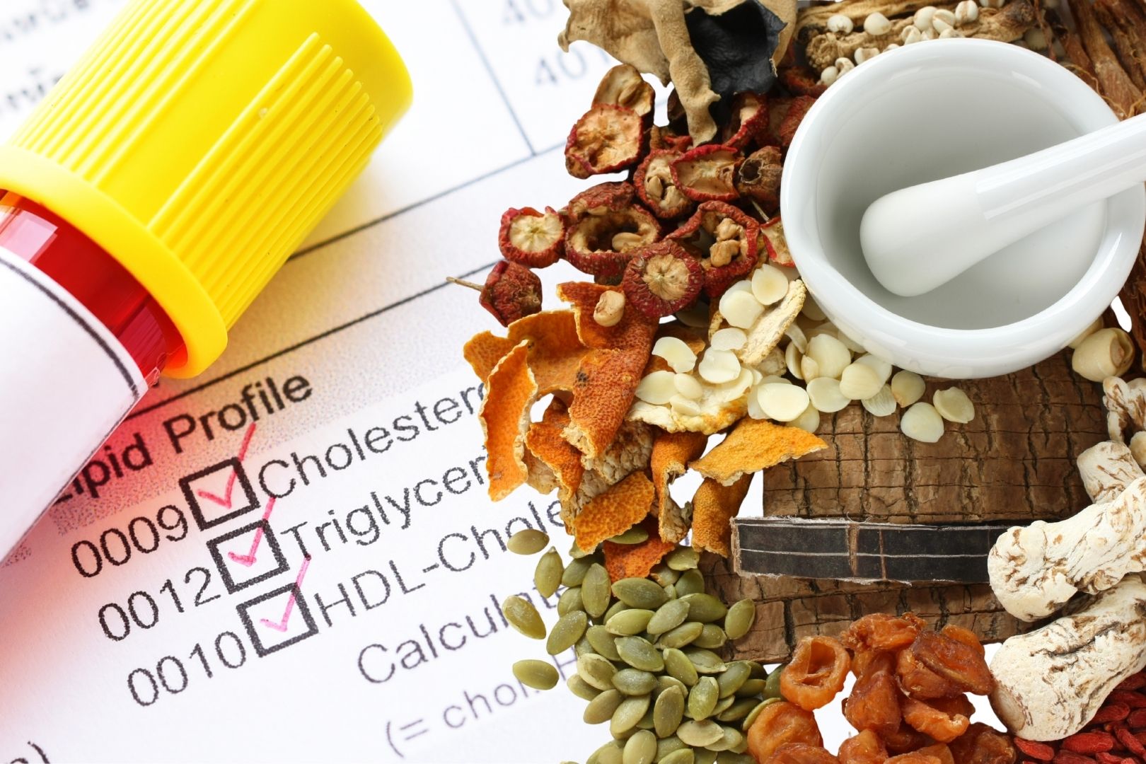 Điều trị rối loạn lipid máu dưới góc nhìn y học cổ truyền