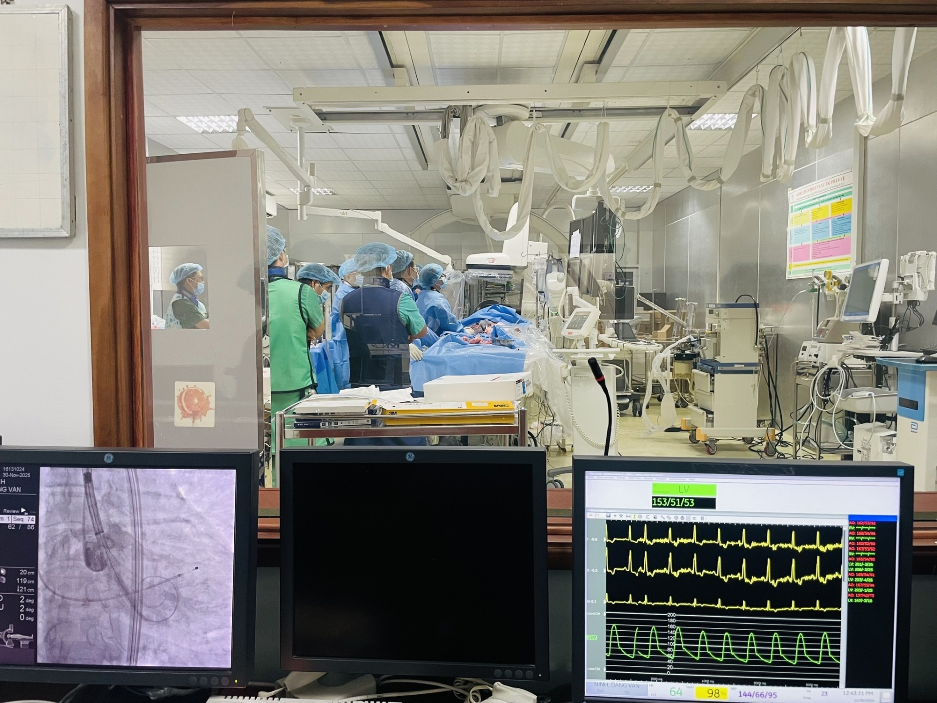 Thay van động mạch chủ qua da thành công cho cụ ông 86 tuổi đa bệnh lý