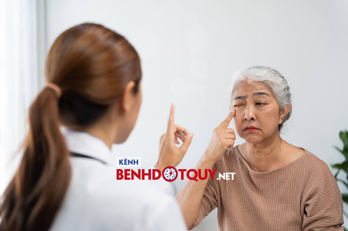 Nhồi máu não gây khuất tầm nhìn một bên mắt, điều trị khỏi được không?