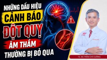 Những dấu hiệu cảnh báo đột quỵ âm thầm thường bị bỏ qua