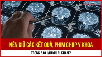 Nên giữ các kết quả, phim chụp y khoa trong bao lâu khi đi khám?