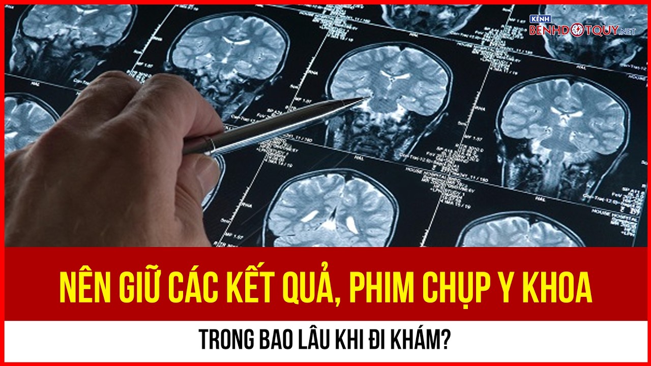 Nên giữ các kết quả, phim chụp y khoa trong bao lâu khi đi khám?